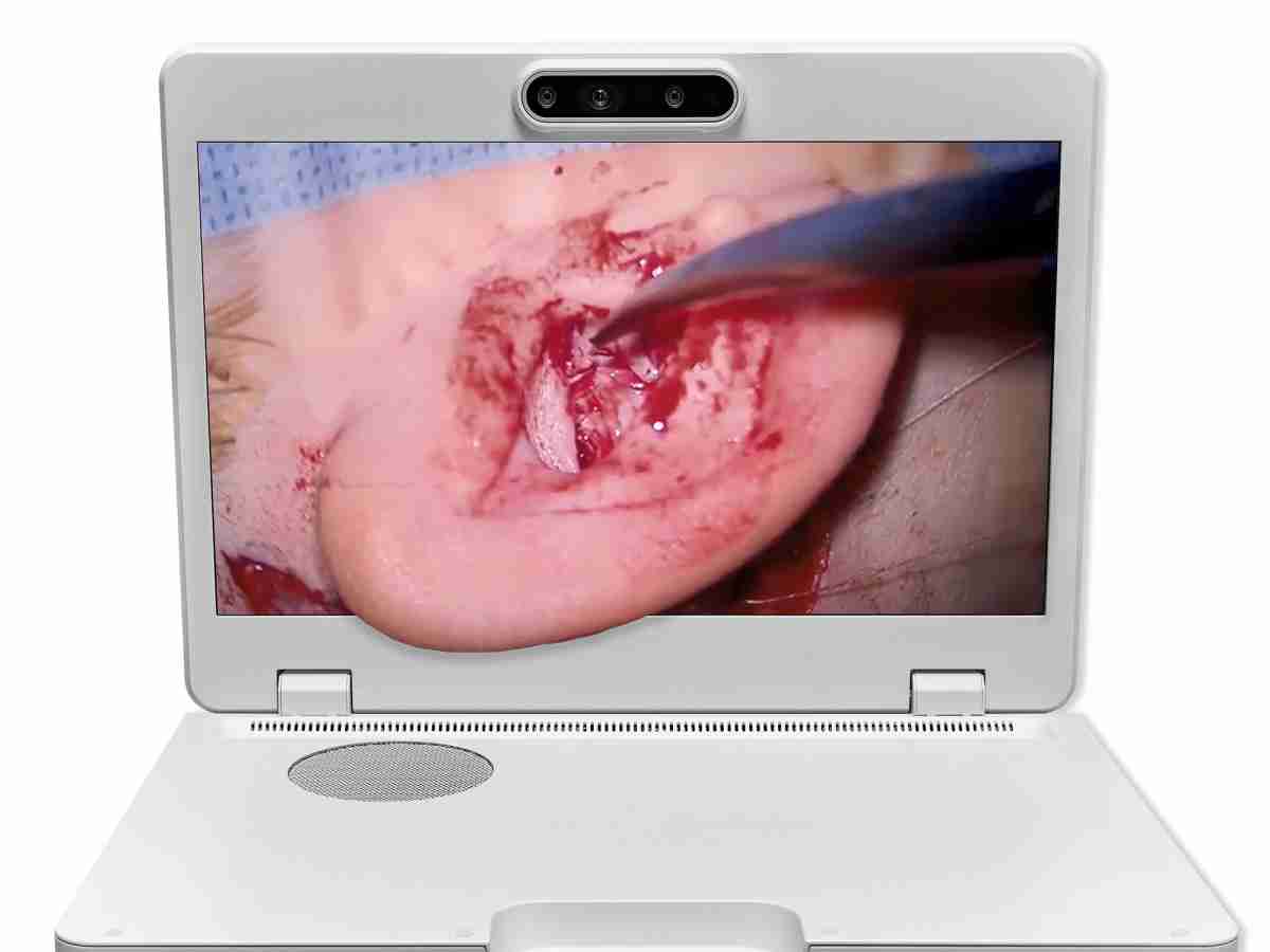 达擎之＂Heads-up 3D显微手术显示系统＂，，整合4K裸眼3D显示及眼球追踪系统，，，，具备快速追踪人眼移动位置功能，，减轻医师长时间维持固定姿势的负担，，，让医师能有更宽广清晰的3D立体视野及更舒适的姿势来执行手术。。。